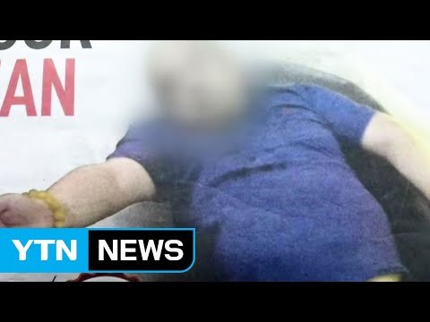 김정남, 소변에서도 VX 검출...장기 손상 / YTN