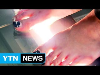 걷기 좋은 계절...'제2의 심장' 발 건강 지키자 / YTN