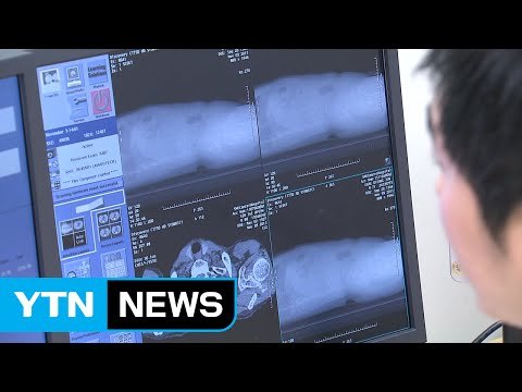 '침묵의 살인자' 췌장암, 예방이 중요하다! / YTN