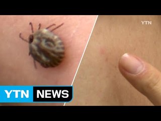 '봄나들이 불청객' 감염병 진드기 조심하세요! / YTN (Yes! Top News)