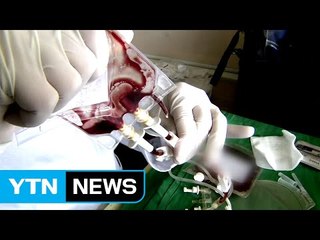 경찰, 차병원 수사..."제대혈 불법 시술" / YTN (Yes! Top News)