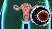 Embarazo masculino: Mujeres transgénero podrían recibir trasplante de útero y tener bebés - TomoNews
