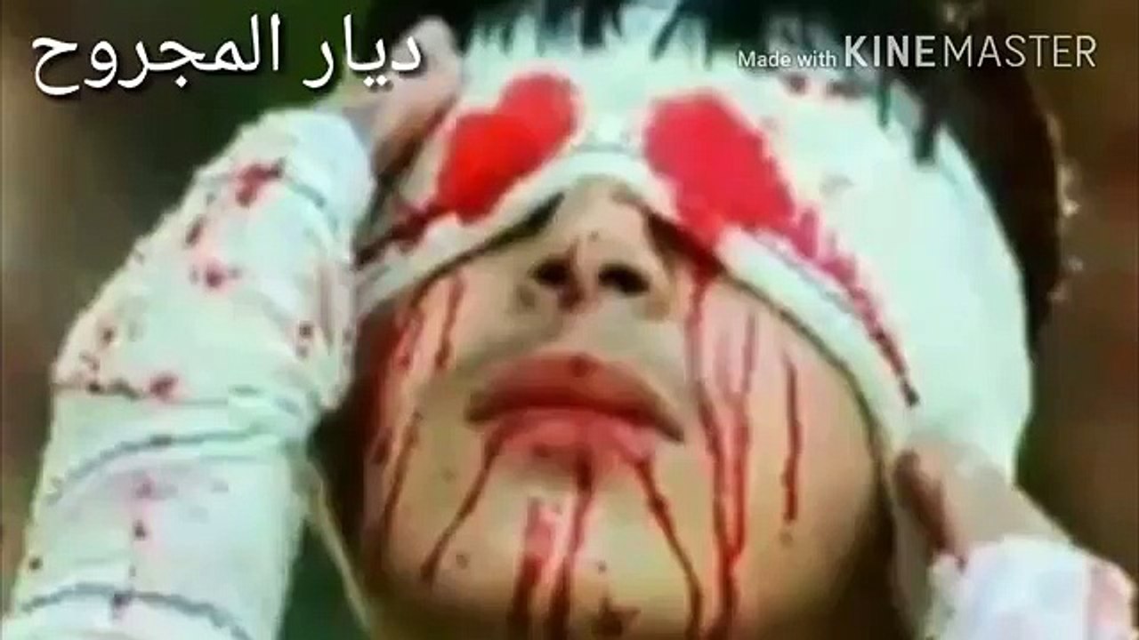 ديار المجر ح