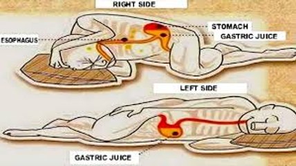 This Is Why You Should Sleep on Your Left Side