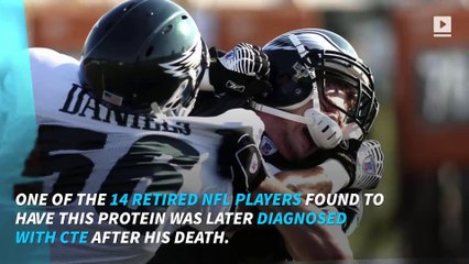 CTE may have just been confirmed in a living person