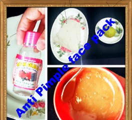 Download Video: How To Remove Pimples Fast  Get Ride Of Pimple and Acne in One Day