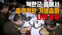 [자막뉴스] 북한군 몸에서 충격적인 기생충이 나온 이유 / YTN