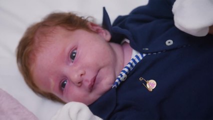 هذا الصباح- ما هو الصفار عند الأطفال؟