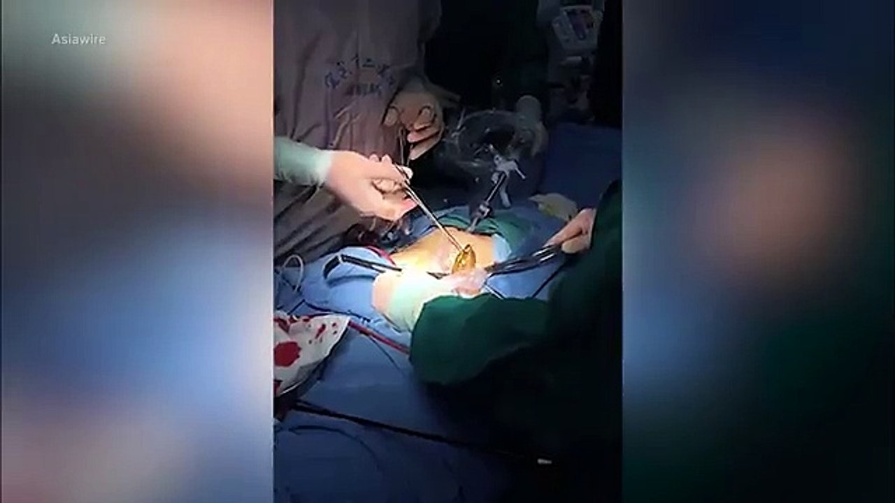Un homme a une anguille coincée dans son derrière