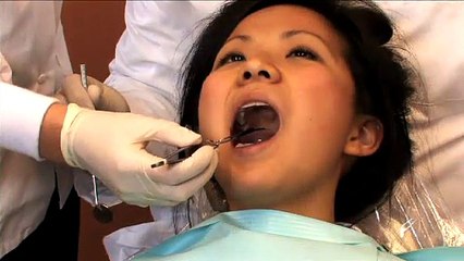 Composite Fillings: Benefits & Info