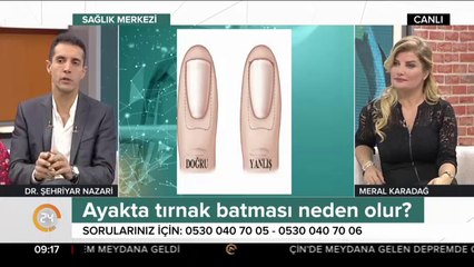 Tırnak batması neden olur ve nasıl düzelir?