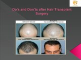 Do's and Don'ts after Hair Transplant Surgery