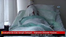 Eskişehir'de Eski Sevgili Dehşeti... Kapısının Önünde Yüzünü Yaktı