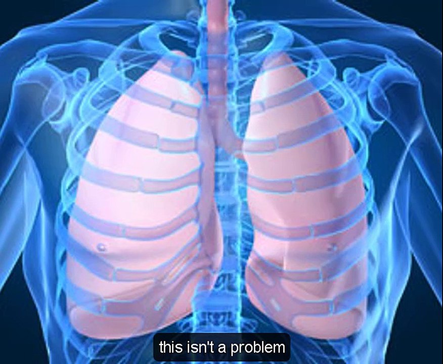 Fighting Fungal Lung Infections with Innovative Inhaled Technology