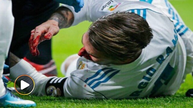 Kapten Real Madrid patah hidung