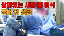 [자막뉴스] 살아있는 사람 폐 이식 국내 첫 성공 / YTN