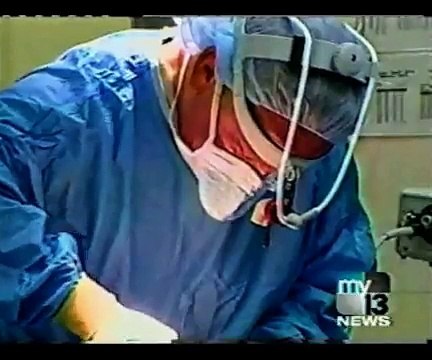 Rhinoplasty Beverly Hills CA