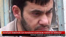 Ameliyat Olabilmek İçin Kendisine Uzatılacak Yardım Eli Bekliyor