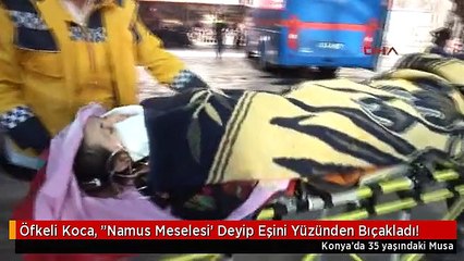 Öfkeli Koca, "Namus Meselesi' Deyip Eşini Yüzünden Bıçakladı!