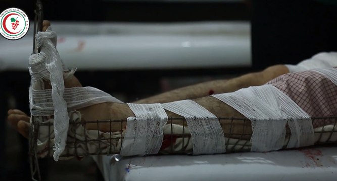 Hospital Uses Improvised Medical Devices as East Damascus Siege Continues