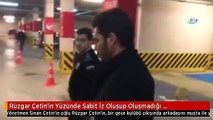 Rüzgar Çetin'in Yüzünde Sabit İz Oluşup Oluşmadığı Araştırılacak