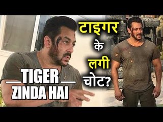 Télécharger la video: Tiger Zinda Hai की Shooting में Salman Khan हुए Injured, Viral हुई Picture