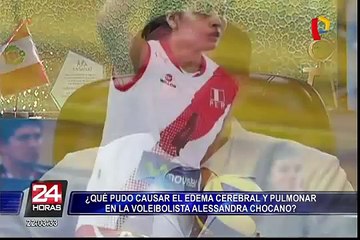 ¿Qué pudo causar el edema cerebral y pulmonar en Alessandra Chocano?