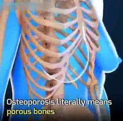 Hospital for Osteoporosis Treatment in India