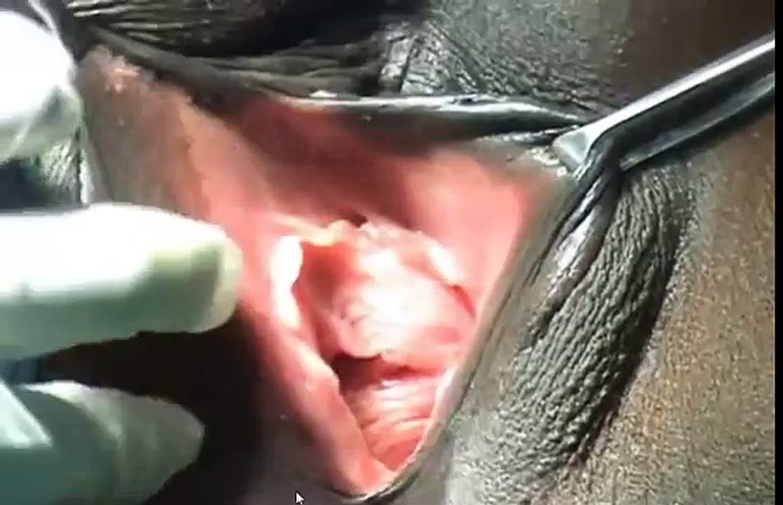 Delineating Vestibular Anatomy