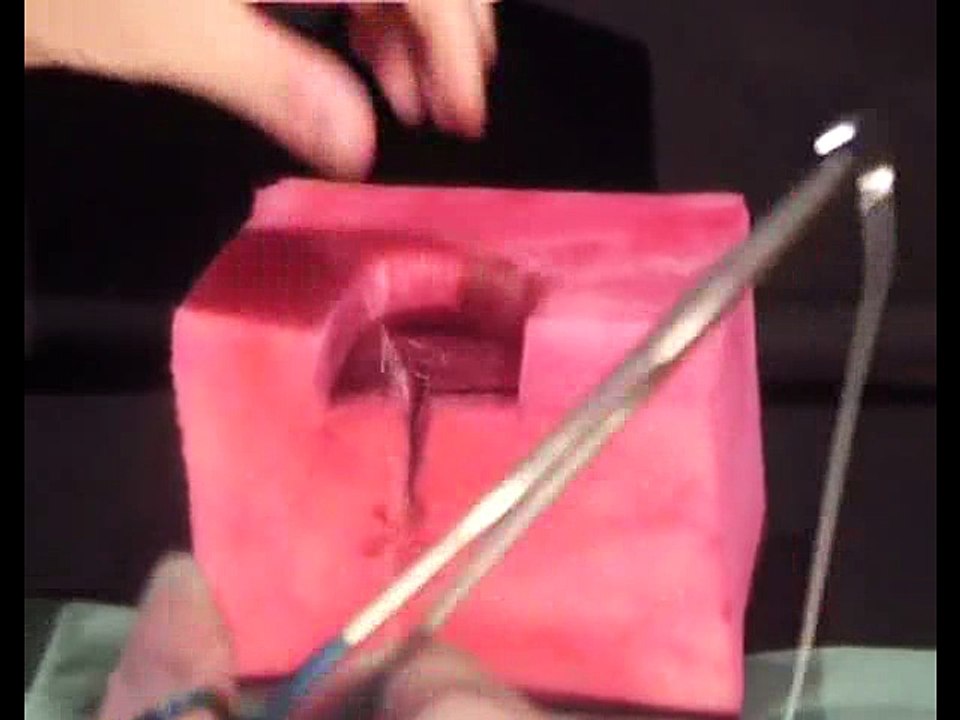 Episiotomy Repair