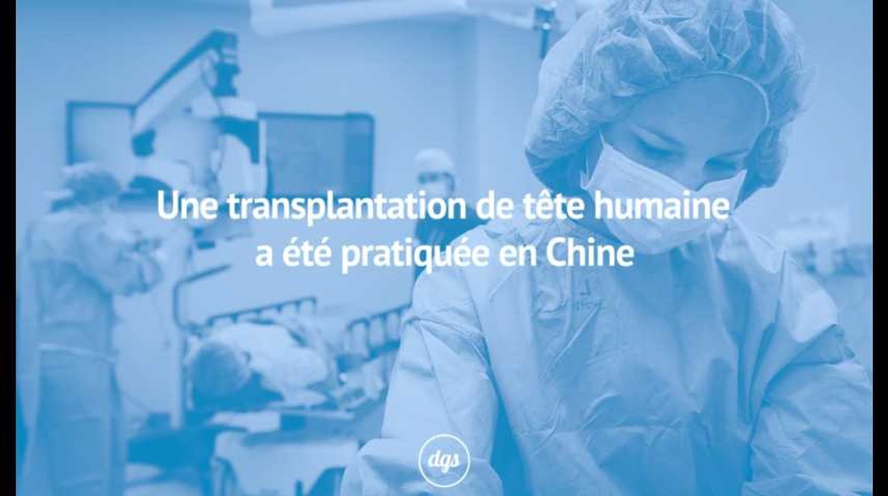 Une transplantation de tête humaine a été pratiquée en Chine
