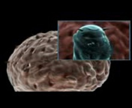 l'escargot de la mort 1000 morts insolites