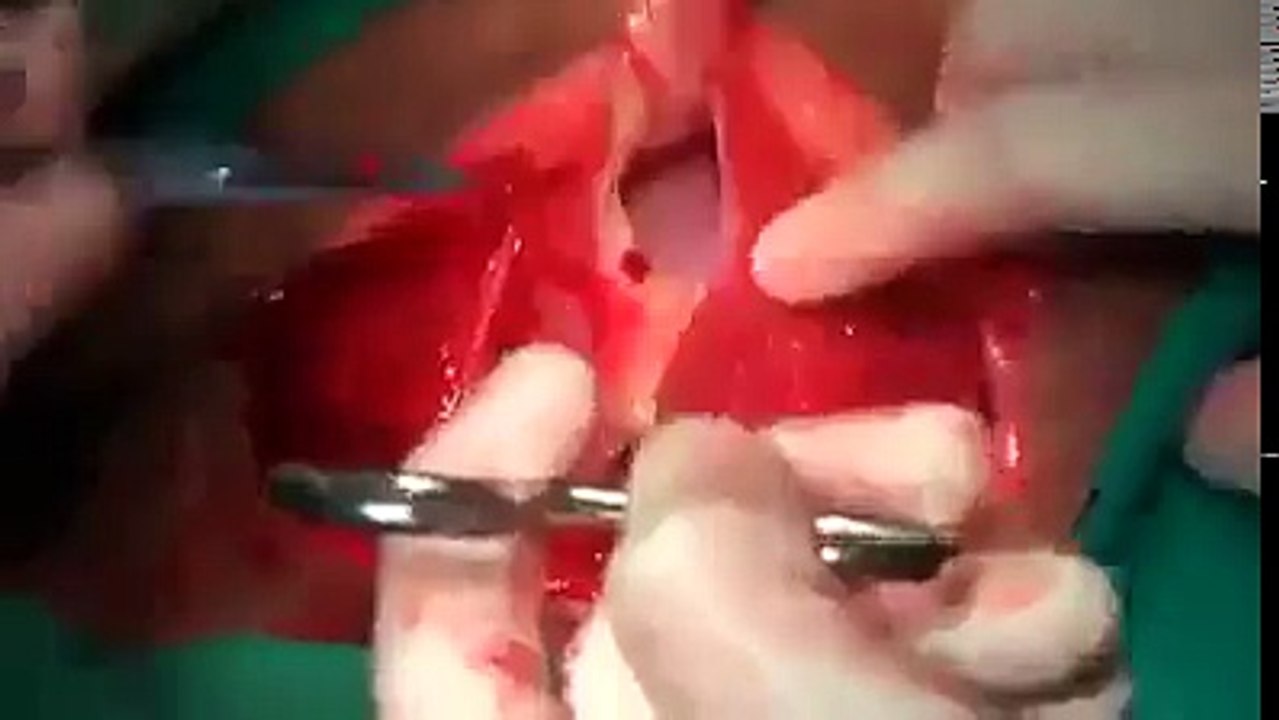 operation