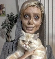 Angelina Jolie'ye Benzemek İçin Bıçak Altına Yatan İranlı Genç Kız, Tanınmaz Halde