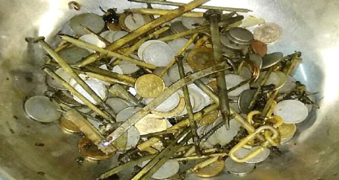 263 Bozuk Para, 100 Çivi! Depresyondaki Adamın Midesinden Çıkanlar Şoke Etti!