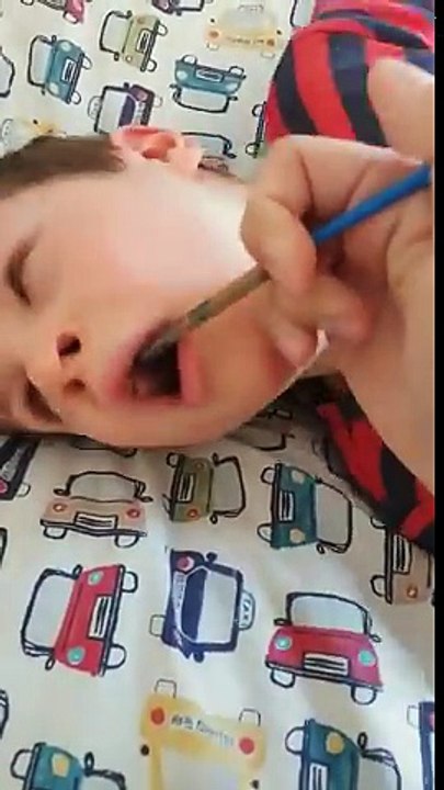 This is how fast Cannabis can stop a seizure!!