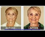 Instant Anti Wrinkle Cream Lifecell All In One Anti Aging Treatment