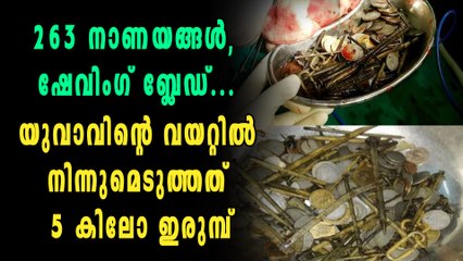 263 നാണയങ്ങളും ഇരുമ്പാണികളും അടക്കം യുവാവിന്‍റെ വയറ്റില്‍ നിന്നും പുറത്തെടുത്തത് 5 കിലോ ഇരുമ്പ്