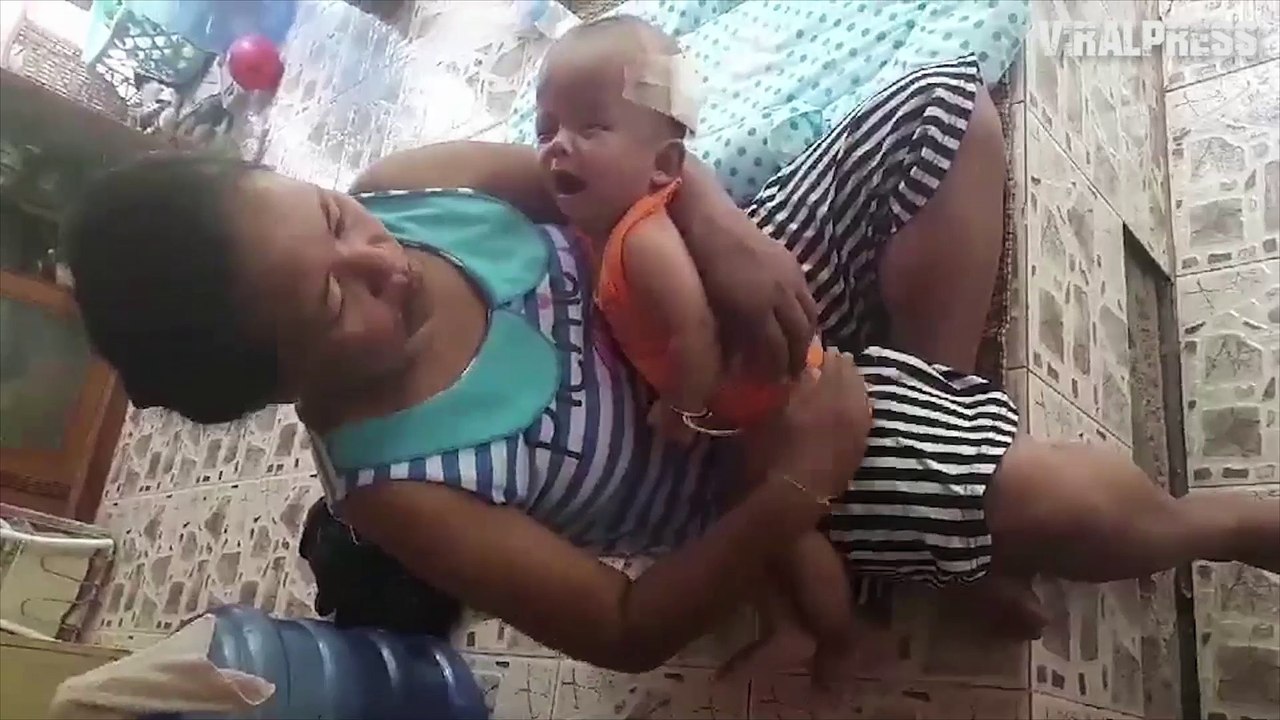 Boy Born With Crack In Skull