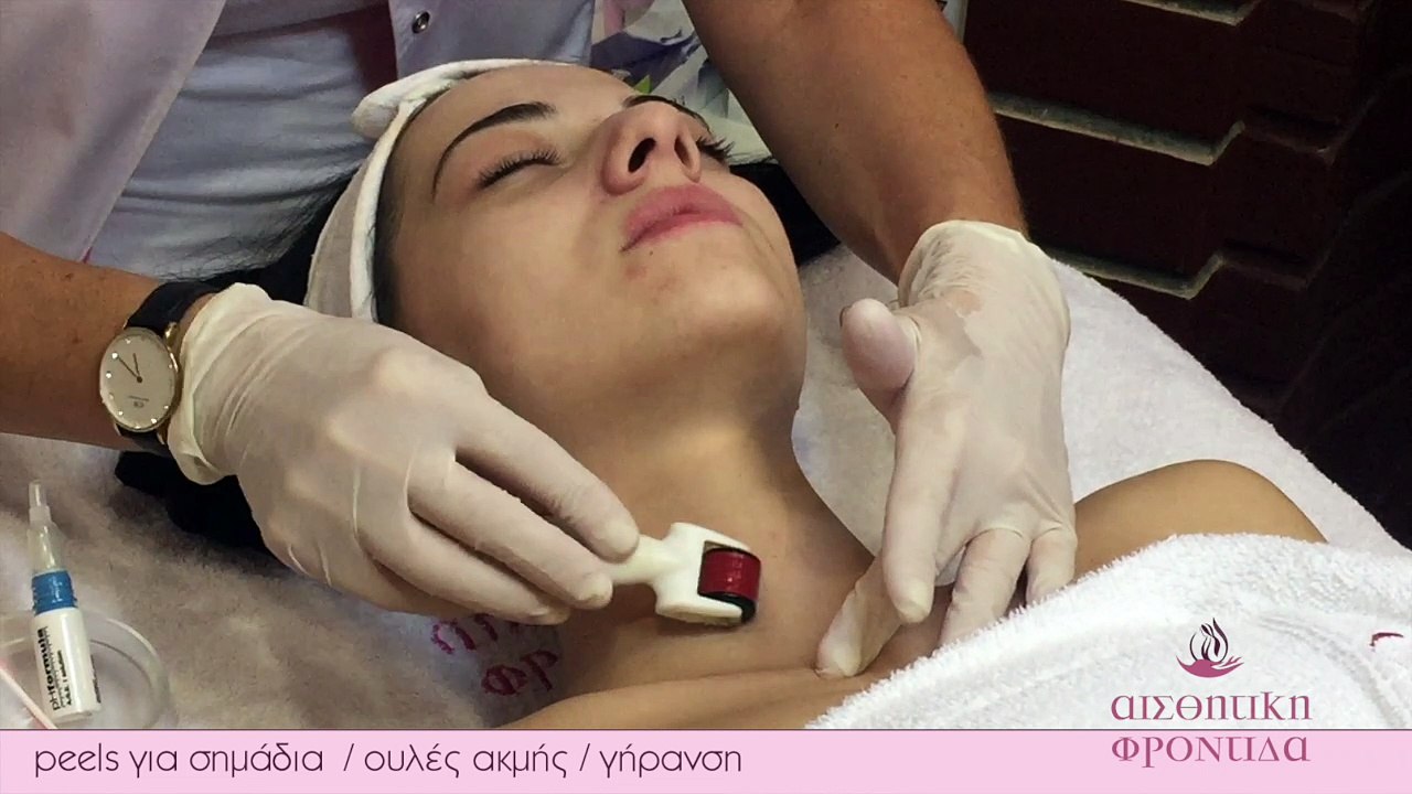 MARKAKI PEELS