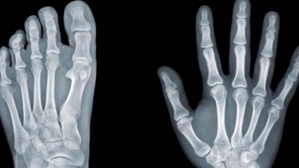 5 Accidental Discoveries That Changed The World!