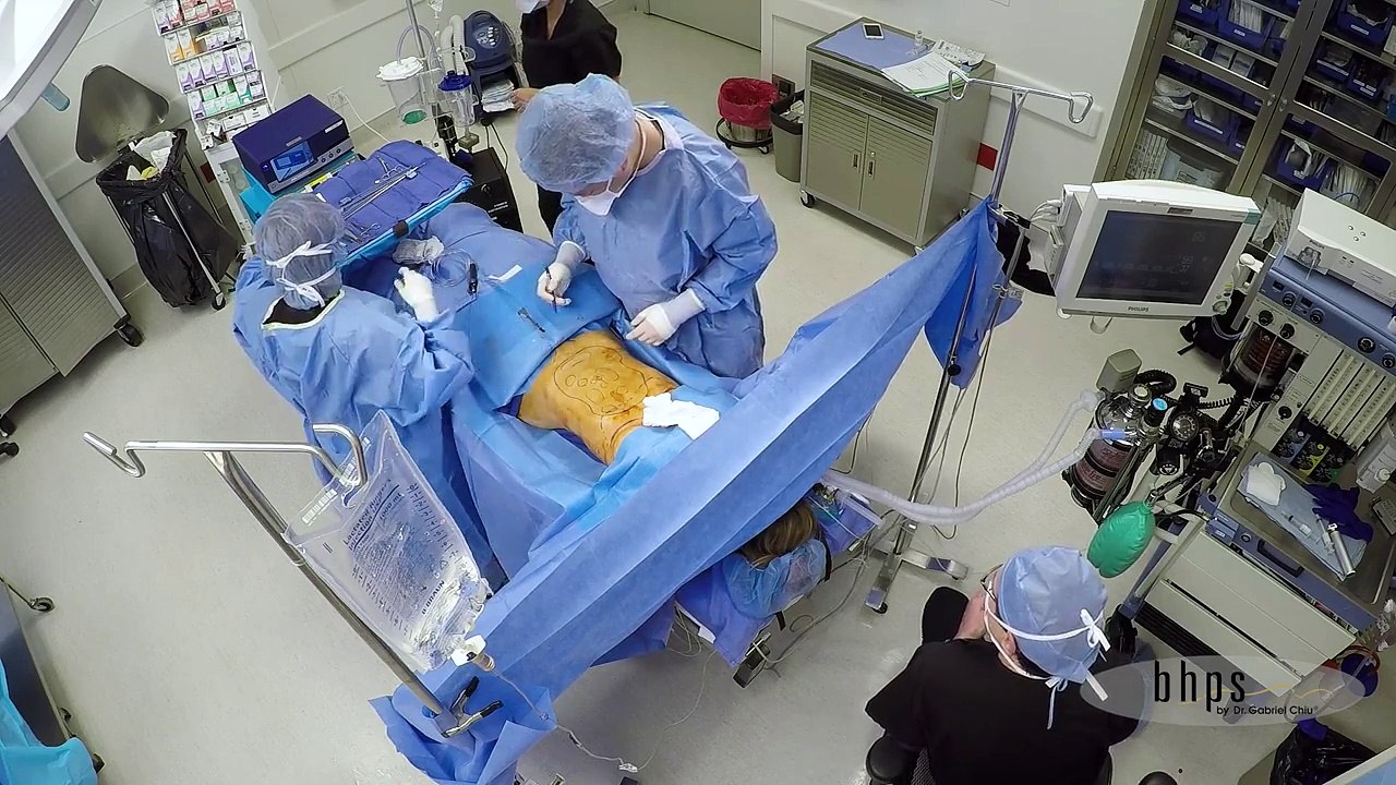 Tummy Tuck Revision
