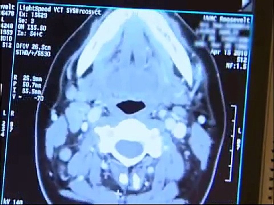 AIMMS LIBRARY VIDEO NO 18 CT SCAN COURSE CT (Computed Tomography) Scan What to expect