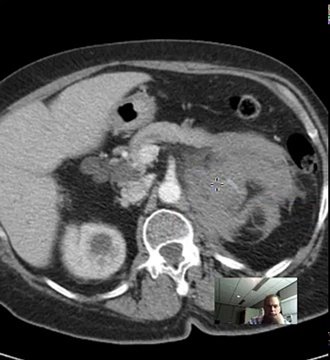 AIMMS LIBRARY VIDEO  NO 20 CT SCAN COURSE CT Abdomen and Pelvis anatomy DISCUSSION