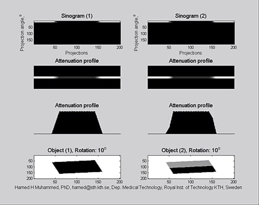 AIMMS LIBRARY VIDEO NO 22 CT SCAN COURSE CT Animation - Computed Tomography How to generate sinograms in a CT scanner