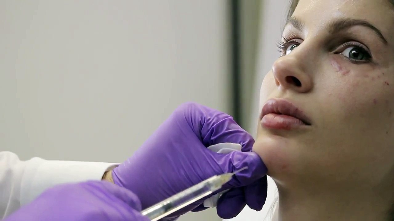 Voluma Chin Filler with Liz and Dr. Harper