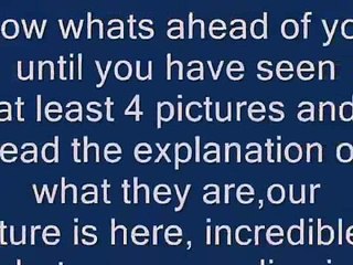 First ever surgery using a robot will help cancer survivor finally conceive