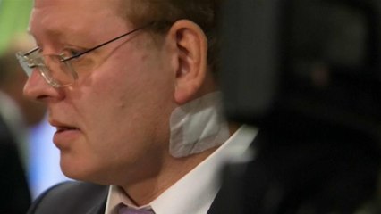 German mayor in knife attack