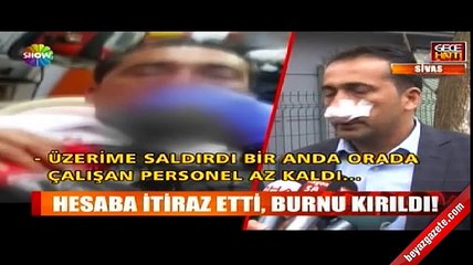 Hesaba itiraz etti burnu kırıldı