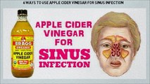 Apple Cider Vinegar For Sinus Infection | Stay Young